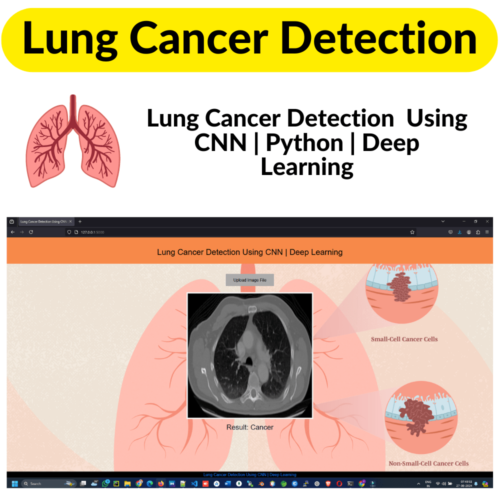 Lung Cancer Detection Using CNN Project with Source Code